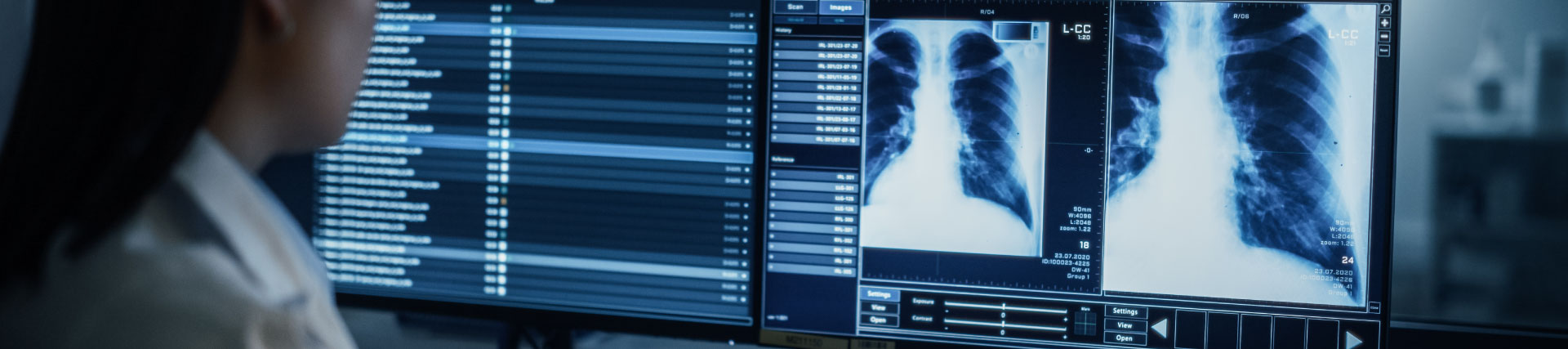 ¿Qué estudiar para trabajar en radiología? Guía de Títulos y Salidas